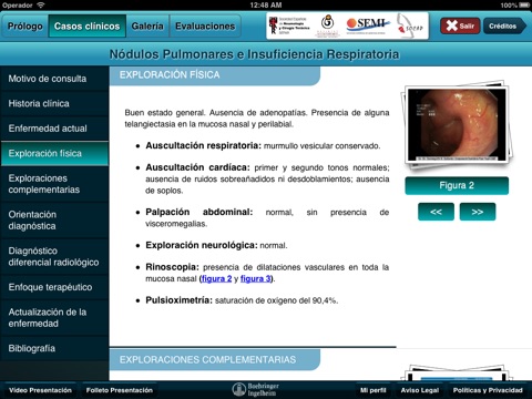 Perlas Clínico Radiológicas del Tórax screenshot 2