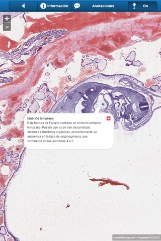 Smart Histology screenshot 3
