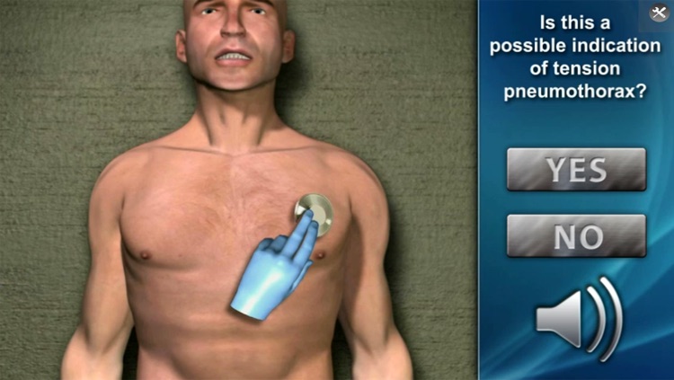 Medrills: NCD for Pneumothorax screenshot-3
