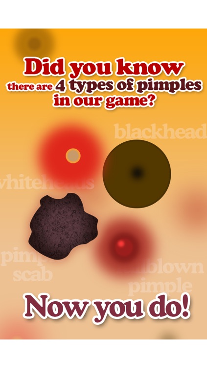 Pimple Popper