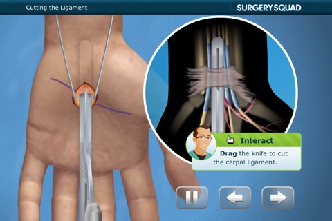 Virtual Carpal Tunnel Surgery screenshot 3