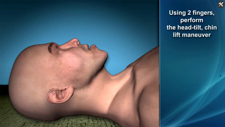 Medrills: Airway Management screenshot-3