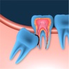 Wisdom Teeth 101:Guide  and Health Tips,Oral Pathology,Dental Hygienist