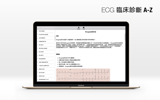 ECG A-Z(圖5)-速報App