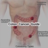 Colon Caner Guide