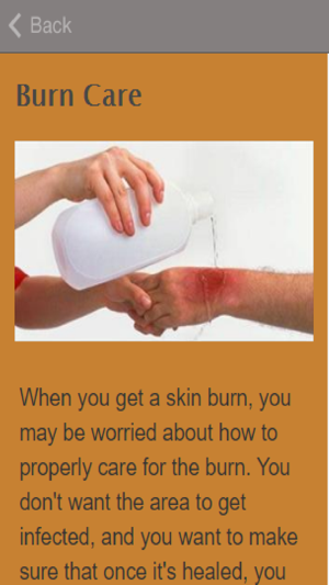 How To Treat Burns(圖2)-速報App