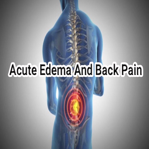 Acute Edema and Back Pain icon