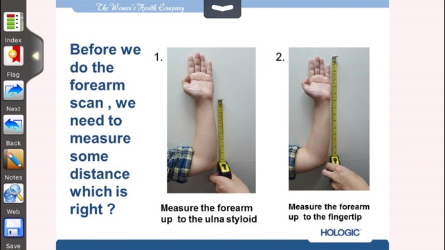 Hologic DXA