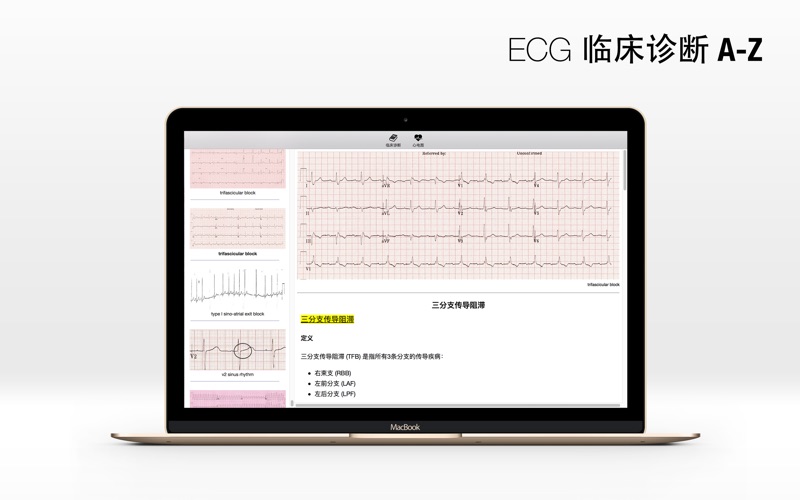 ECG A-Z