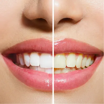 Teeth Whitening Tips - Learn How to Whiten Teeth Cheats