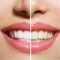 Learn How to Get Whiter Teeth at Home from this app