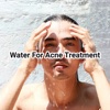 Water For Acne Treatment