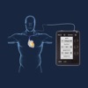 Temporary Cardiac Pacing