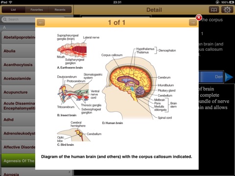 Encyclopedia of Neurological Disorders screenshot 4