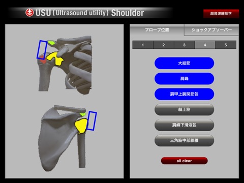 USU Shoulder screenshot 4