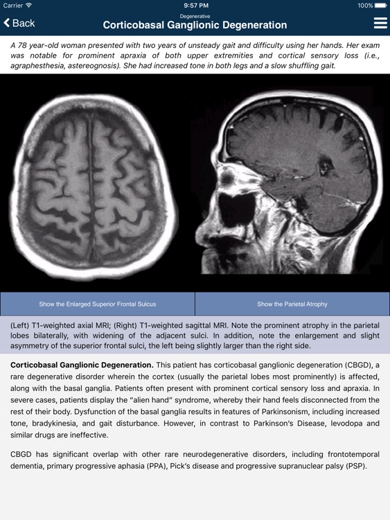 Nina: Neuroimaging In Neurology App (Full Version) screenshot-4