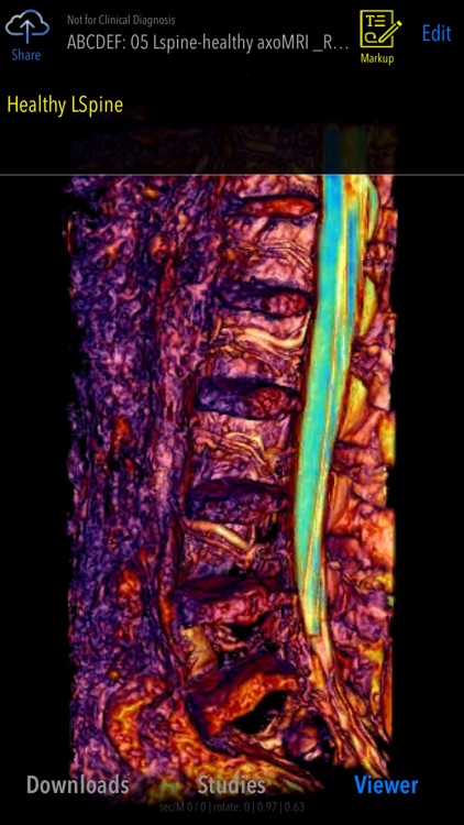 MedVizi Medical Imaging screenshot-4