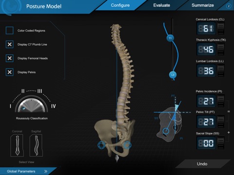 CATALYST™ Spino-Pelvic Posture Simulation screenshot 4