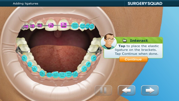 Virtual Braces screenshot-3