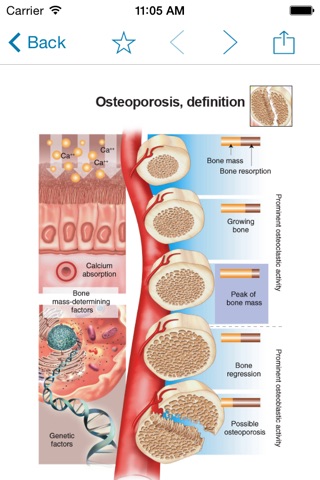 Miniatlas Osteoporosis screenshot 4