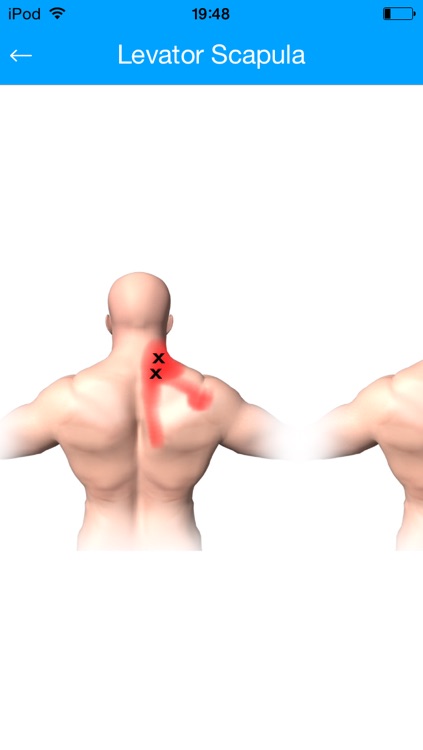 Muscle Trigger Points Massage Therapy screenshot-4