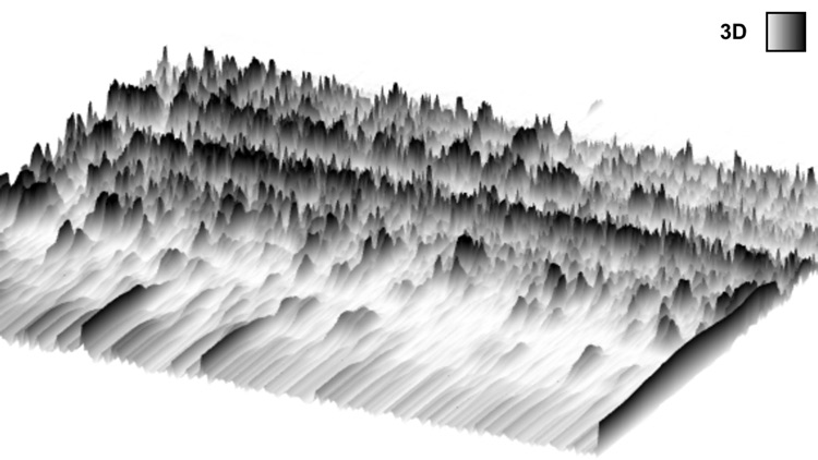 Spectrograph