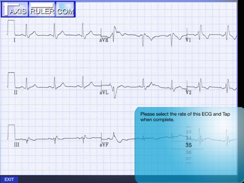 ECG Genius screenshot 3