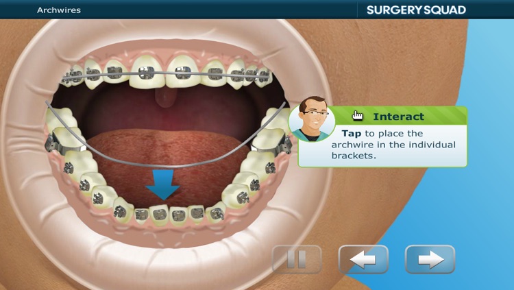 Virtual Braces