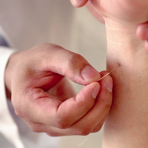 Acupuncture Guide - Everything You Need To Know About Acupuncture Treatment! icon