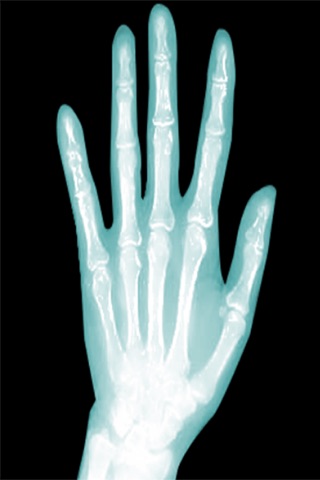X-Ray Scanner -free screenshot 2