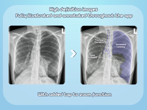 iChest Xrays screenshot 4