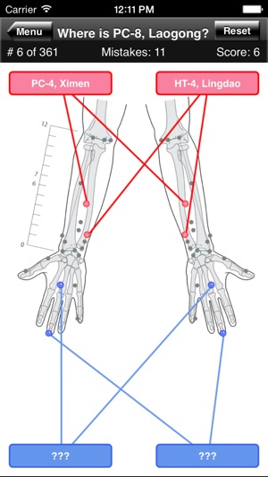 Acupuncture Points Body Quiz(圖3)-速報App