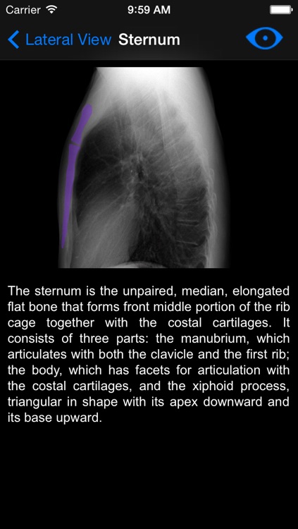 Chest X-ray screenshot-4