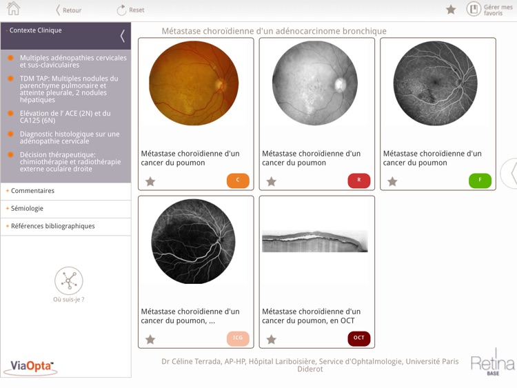 Retina Base