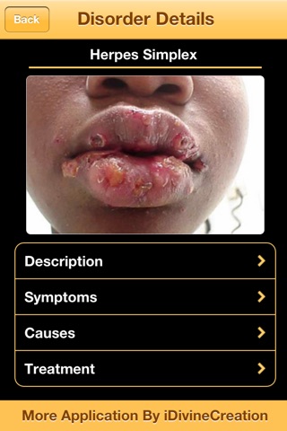 Most Skin Disorders screenshot 3