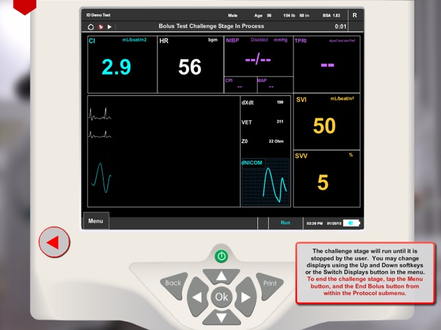 Cheetah Medical's Advanced Hemodynamic Monitoring System(圖3)-速報App