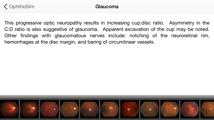 OphthoSim Companion Full screenshot-4