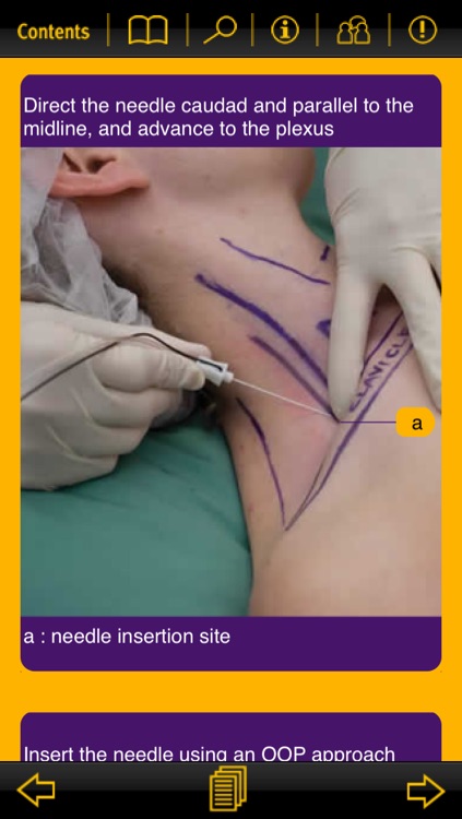 Nerve Blocks screenshot-3