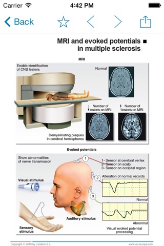 Miniatlas Multiple Sclerosis screenshot 3