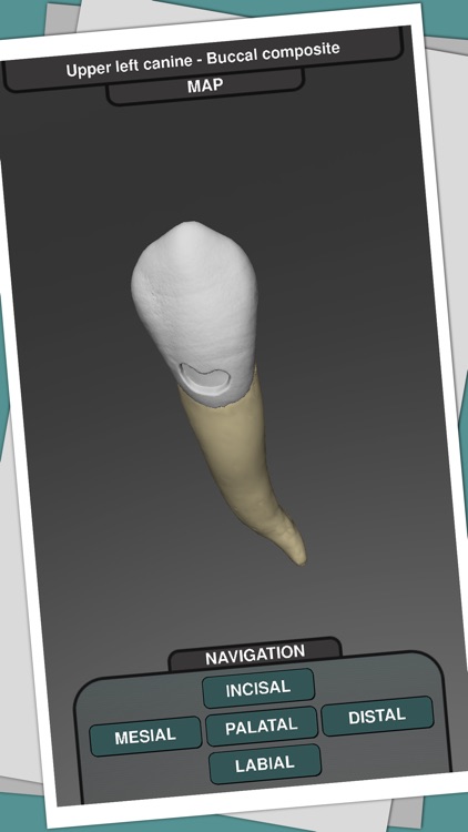 CavSim : 3D Dental Restorative Tooth Cavity Preparation