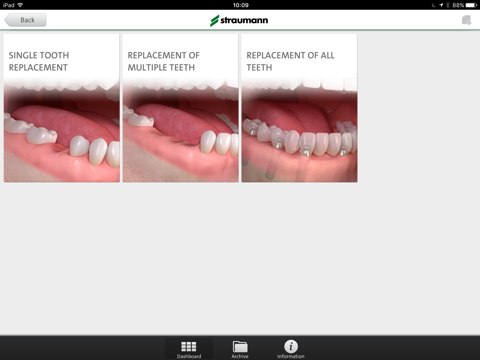 Straumann® Patient Education App screenshot 3