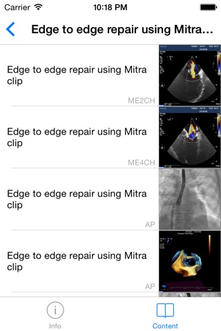 CARDIO3® Interventional Atlas screenshot 3