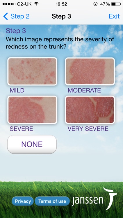 Psoriasis 360