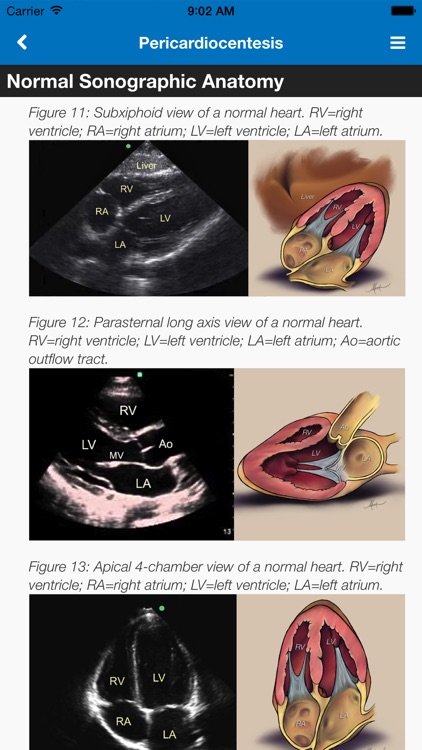SonoSupport: a clinical emergency medicine and critical care ultrasound reference tool