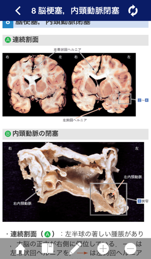 ATLAS OF PATHOLOGY And Comparison With Normal Anatomy(圖2)-速報App