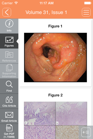 Journal of Gastroenterology and Hepatology screenshot 2