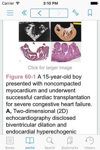 Diagnosis and Management of Adult Congenital Heart Disease, 2nd Edition screenshot 3