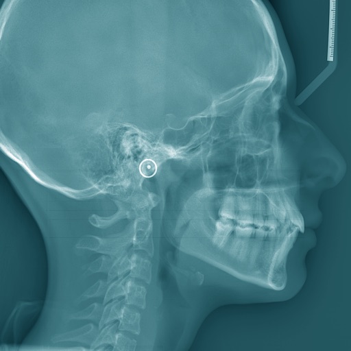 Oral Radiology