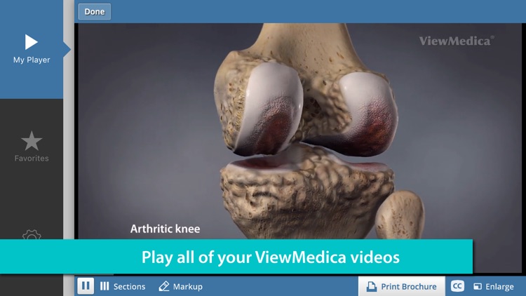 ViewMedica Patient Education Videos