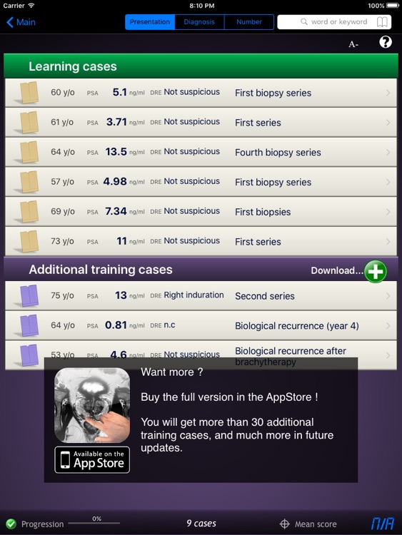 Prostate Cancer Imaging LITE